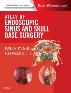 ATLAS OF ENDOSCOPIC SINUS AND SKULL BASE SURGERY