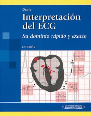 INTERPRETACION DE ECG SU DOMINIO RAPIDO Y EXACTO